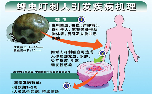蜱蟲咬後症(zhèng)狀似“感冒”,請引起(qǐ)十二萬分警惕!