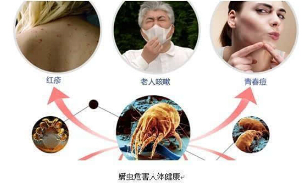 蟎蟲怎麽去除?除蟲公司提供**方法