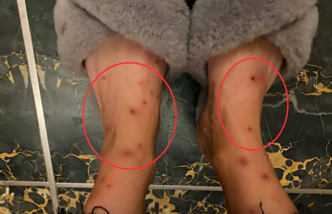 一(yī)小區跳(tiào)蚤泛濫!跳蚤究竟哪來的?